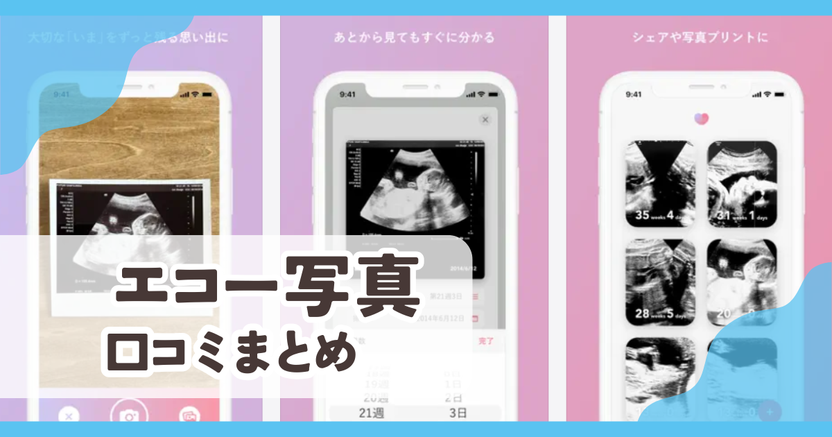 【エコー写真】口コミ評判まとめ