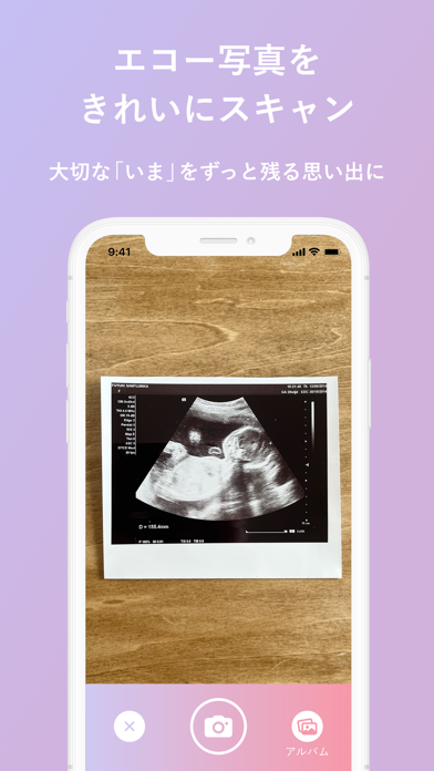 エコー写真のスクリーンショット1