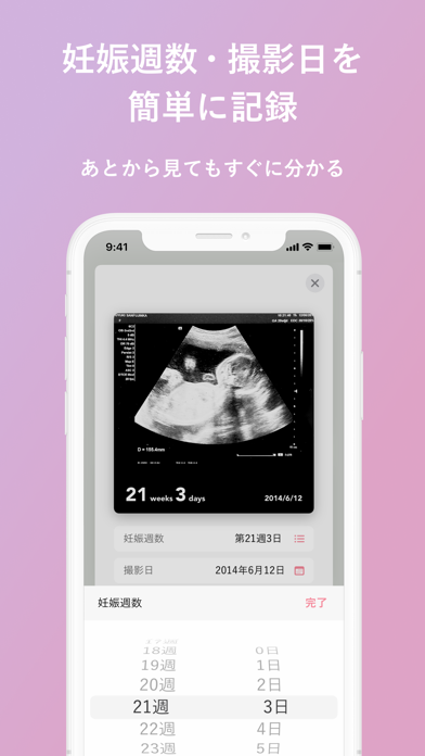 エコー写真のスクリーンショット2