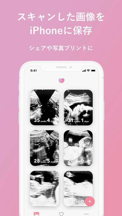 エコー写真のスクリーンショット3